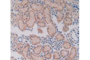 Used in DAB staining on fromalin fixed paraffin- embedded kidney tissue (CYP7A1 Antikörper  (AA 109-383))