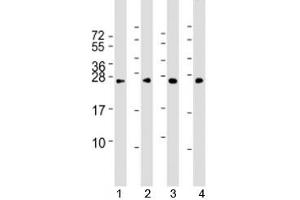 Western blot testing of human 1) HeLa, 2) HepG2, 3) Jurkat and 4) mouse NIH3T3 cell lysate with RAB5B antibody at 1:2000. (RAB5B Antikörper)