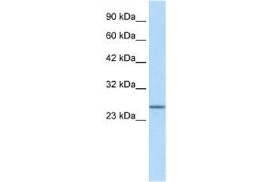 WB Suggested Anti-SOX14 Antibody Titration:  1.