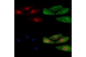 ABIN6256959 and ABIN6274926 staining  cells by IF/ICC. (BCAS2 Antikörper  (Internal Region))
