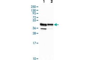 Western blot analysis of Lane 1: Human cell line RT-4 Lane 2: Human cell line U-251MG with RCN3 polyclonal antibody  at 1:500-1:1000 dilution. (RCN3 Antikörper)