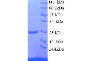 SDS-PAGE (SDS) image for Hepatitis A Virus Cellular Receptor 2 (TIM 3) (AA 22-202), (Extracellular) protein (His tag) (ABIN5713498)