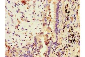 Immunohistochemistry (IHC) image for anti-Signal Transducer and Activator of Transcription 2, 113kDa (STAT2) (AA 571-851) antibody (ABIN7169671)