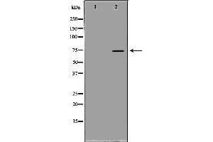SCNN1B 抗体  (C-Term)