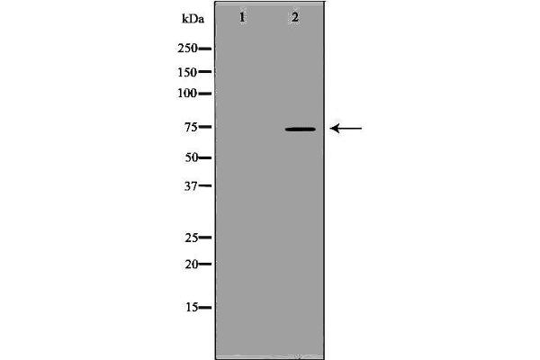 SCNN1B 抗体  (C-Term)