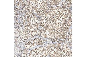 IHC analysis of Syntenin 2/SDCBP2 using anti-Syntenin 2/SDCBP2 antibody (ABIN7600017). (SDCBP2 Antikörper  (AA 14-292))