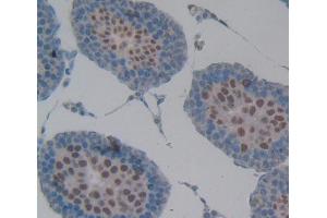 Used in DAB staining on fromalin fixed paraffin- embedded testis tissue (RNASEH2A Antikörper  (AA 1-301))