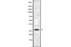 Western blot analysis of TP53INP1 using HepG2 whole cell lysates (TP53INP1 Antikörper  (Internal Region))