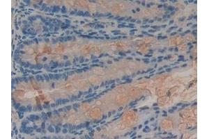 Detection of PLA2R1 in Mouse Intestine Tissue using Polyclonal Antibody to Phospholipase A2 Receptor 1 (PLA2R1)