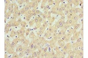Immunohistochemistry of paraffin-embedded human liver tissue using ABIN7168635 at dilution of 1:100 (Sclerostin Antikörper  (AA 24-213))