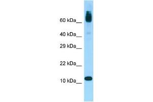 WB Suggested Anti-ACYP1 Antibody Titration: 1. (ACYP1 Antikörper  (Middle Region))