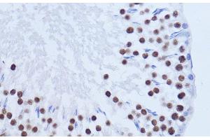 Immunohistochemistry of paraffin-embedded Rat testis using MATR3 Polyclonal Antibody at dilution of 1:100 (40x lens). (MATR3 Antikörper)