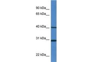 Image no. 1 for anti-Histocompatibility 13 (H13) (AA 240-289) antibody (ABIN6746312) (H13 Antikörper  (AA 240-289))
