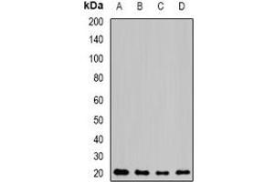 Western blot analysis of NAT5 expression in MCF7 (A), mouse kidney (B), mouse heart (C), rat lung (D) whole cell lysates. (NAT5 Antikörper)