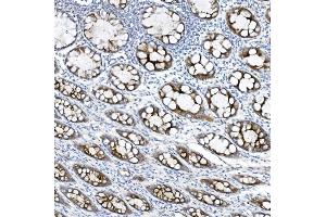IHC analysis of MUC5B using anti-MUC5B antibody (ABIN7602056).