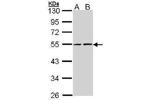 WB Image Sample (30 ug of whole cell lysate) A: A431 , B: H1299 10% SDS PAGE antibody diluted at 1:5000 (RUVBL2 Antikörper  (C-Term))