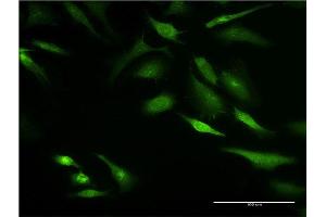 Immunofluorescence (IF) image for anti-Keratin 8 (KRT8) (AA 91-195) antibody (ABIN517391)