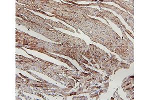IHC analysis of LPP using anti-LPP antibody (ABIN7599606). (LPP Antikörper  (AA 10-572))