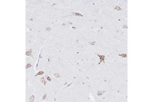 Immunohistochemical staining of human hippocampus with FAM3C polyclonal antibody  shows strong granular cytoplasmic positivity in neurons at 1:1000-1:2500 dilution. (FAM3C Antikörper)