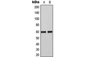 Western blot analysis of SMAD3 (pS425) expression in A431 EGF-treated (A), HL60 TGF-treated (B) whole cell lysates.