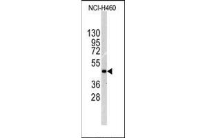 Image no. 1 for anti-Integrin-Linked Kinase (ILK) (Thr173) antibody (ABIN359883) (ILK Antikörper  (Thr173))