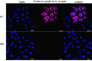 Immunocytochemical staining of HepG2 cells using Epidermal growth factor receptor antibody (ABIN7798472), 1:1,000), Top panel: wild-type (WT), Bottom panal: Adiponectin receptor 1 shRNA knockdown (KD). (EGFR Antikörper)