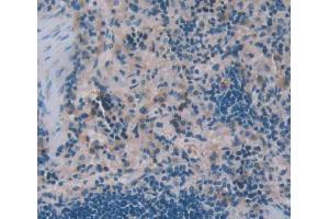 Used in DAB staining on fromalin fixed paraffin- embedded Kidney tissue (WASP Antikörper  (AA 1-298))