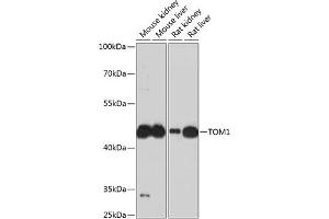 Western blot analysis of extracts of various cell lines, using TOM1 antibody (ABIN6128832, ABIN6149379, ABIN6149380 and ABIN6224955) at 1:3000 dilution. (TOM1 Antikörper  (AA 314-493))