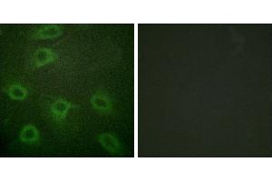 P-peptide - +Immunofluorescence analysis of HeLa cells, using BAD (Phospho-Ser134) antibody. (BAD Antikörper  (pSer134))