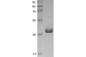 Validation with Western Blot (SENP8 Protein (Transcript Variant 1) (His tag))