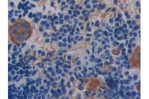 DAB staining on IHC-P; Samples: Mouse Spleen Tissue (Integrin beta 3 Antikörper  (AA 134-376))
