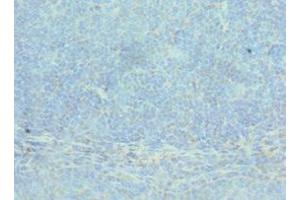 Immunohistochemistry of paraffin-embedded human tonsil tissue using ABIN7143075 at dilution of 1:100