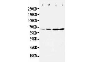 Anti-Dopamine Receptor D1 antibody, Western blotting Lane 1: Rat Testis Tissue Lysate Lane 2: Rat Brain Tissue Lysate Lane 3: U87 Cell Lysate Lane 4: HELA Cell Lysate (Dopamine Receptor d1 Antikörper  (Middle Region))