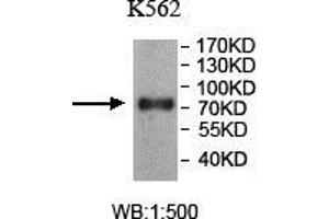 Western blot analysis of K562 lysate, using TTC25 antibody.