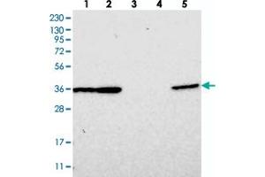 Western blot analysis of Lane 1: RT-4, Lane 2: U-251 MG, Lane 3: Human Plasma, Lane 4: Liver, Lane 5: Tonsil with DNAJB14 polyclonal antibody  at 1:250-1:500 dilution. (DNAJB14 Antikörper)