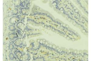 ABIN6279736 at 1/100 staining Mouse colon tissue by IHC-P. (RAB32 Antikörper  (C-Term))
