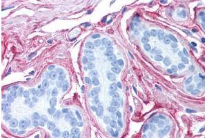 Human Breast (formalin-fixed, paraffin-embedded) stained with Collagen VI antibody ABIN364508 at 2. (COL6 Antikörper)
