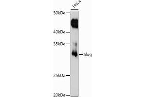 Western blot analysis of extracts of HeLa cells, using Slug antibody (ABIN3021317, ABIN3021318, ABIN3021319 and ABIN6214866) at 1:1000 dilution. (SLUG Antikörper  (AA 89-268))