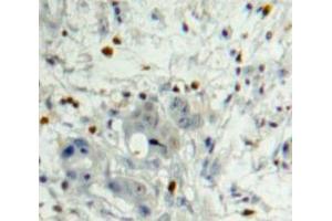 Used in DAB staining on fromalin fixed paraffin-embedded Pancreas tissue (PDGFB Antikörper  (AA 21-241))