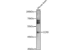 Western blot analysis of extracts of Mouse brain, using CCR9 antibody (ABIN7266312) at 1:1000 dilution. (CCR9 Antikörper  (AA 1-100))
