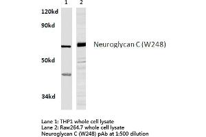 Western blot (WB) analysis of Neuroglycan C antibody in extracts from THP1 and raw264. (CSPG5 Antikörper)