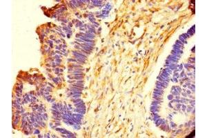Immunohistochemistry of paraffin-embedded human ovarian tissue using ABIN7151610 at dilution of 1:100