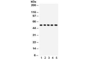 Western blot testing of 1) rat liver, 2) rat testis, 3) human HeLa, 4) RH35, and 5) HEPA lysate with SSH3BP1 antibody.