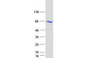 Western Blotting (WB) image for RAD23 Homolog A (RAD23A) protein (Myc-DYKDDDDK Tag) (ABIN2730399)