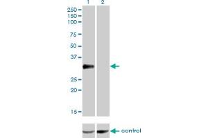 Western blot analysis of CRX over-expressed 293 cell line, cotransfected with CRX Validated Chimera RNAi (Lane 2) or non-transfected control (Lane 1). (CRX Antikörper  (AA 1-300))