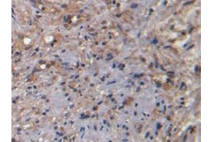 DAB staining on IHC-P; Samples: Human Prostate Tissue)