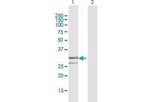 Western Blot analysis of ENDOG expression in transfected 293T cell line by ENDOG MaxPab polyclonal antibody. (Endonuclease G Antikörper  (AA 50-297))