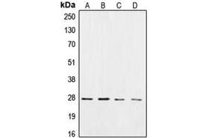 Western blot analysis of CK2 beta expression in HeLa (A), Jurkat (B), mouse brain (C), rat brain (D) whole cell lysates. (CSNK2B Antikörper  (C-Term))