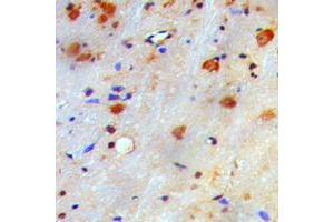 Immunohistochemical analysis of nm23-H1 staining in human brain formalin fixed paraffin embedded tissue section. (NME1 Antikörper  (Center))