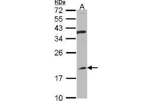 WB Image Sample(30 ug whole cell lysate) A:Raji , 12% SDS PAGE antibody diluted at 1:1000 (IFNA8 Antikörper)